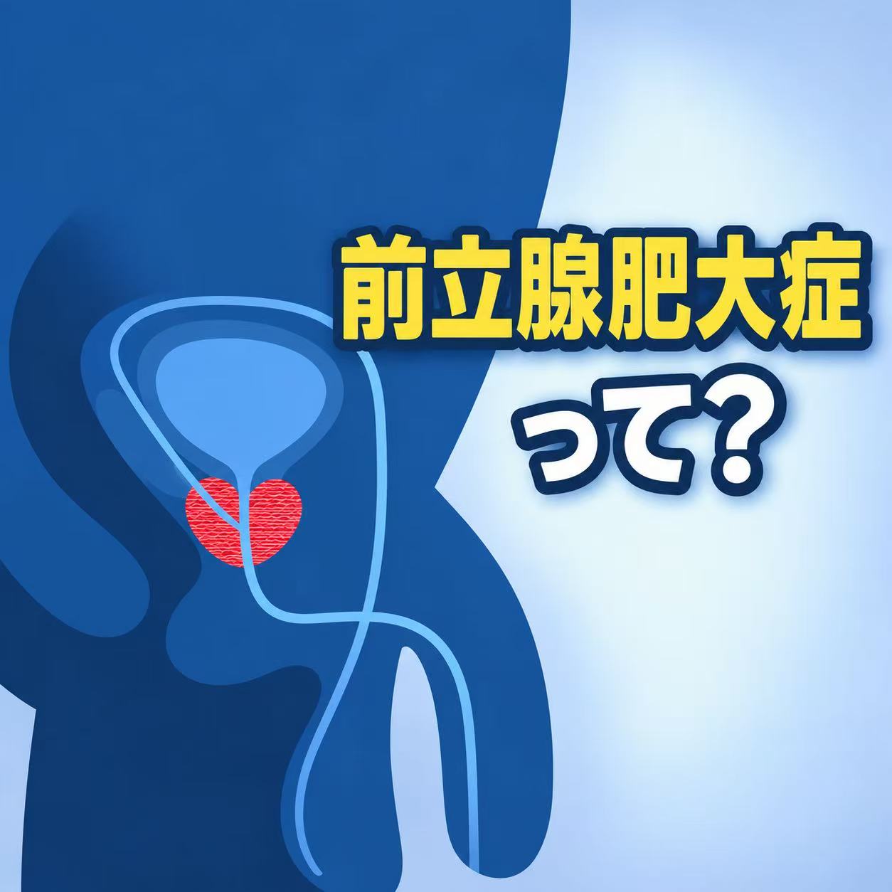 前立腺肥大症について知っておきたいこと